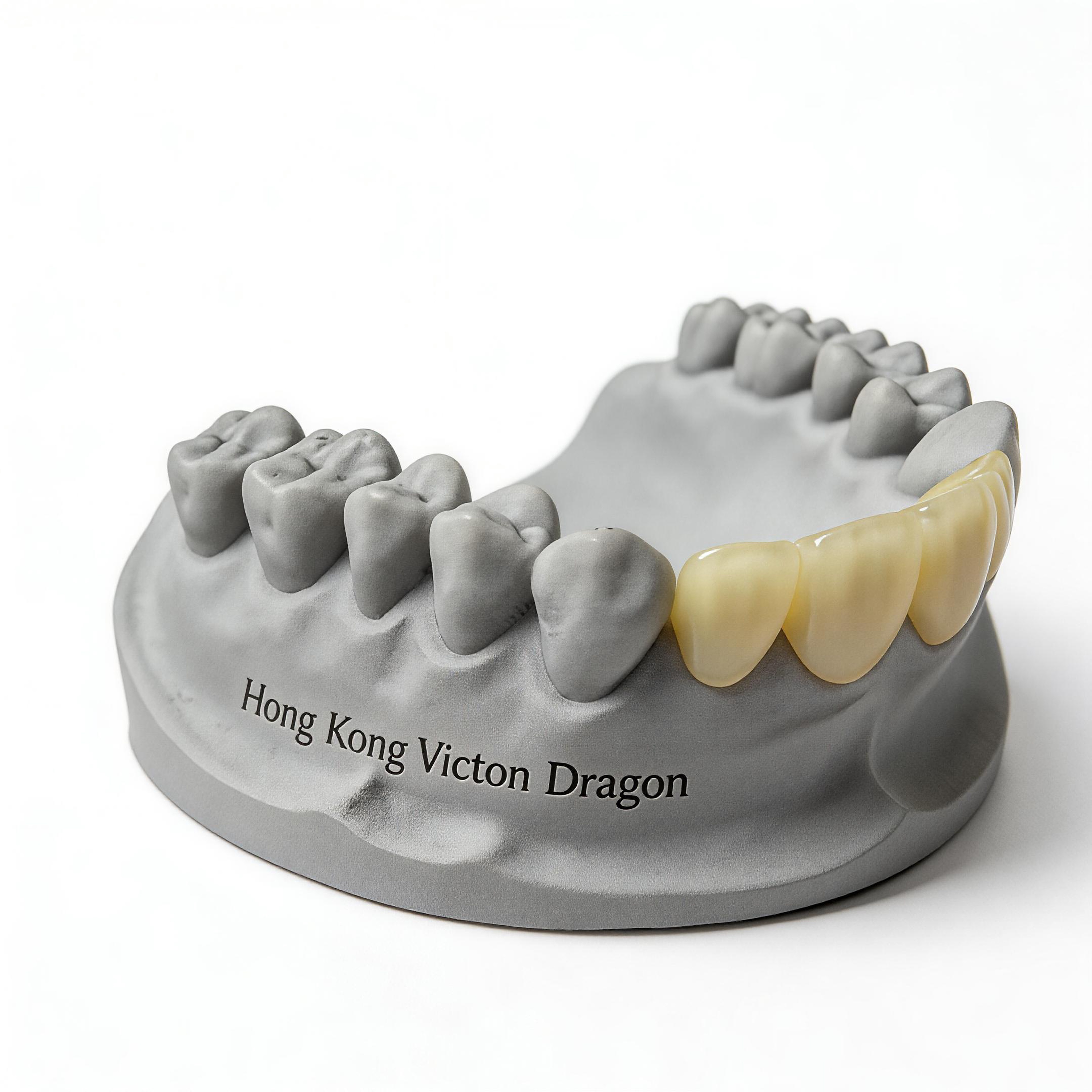 Fixed Restorations