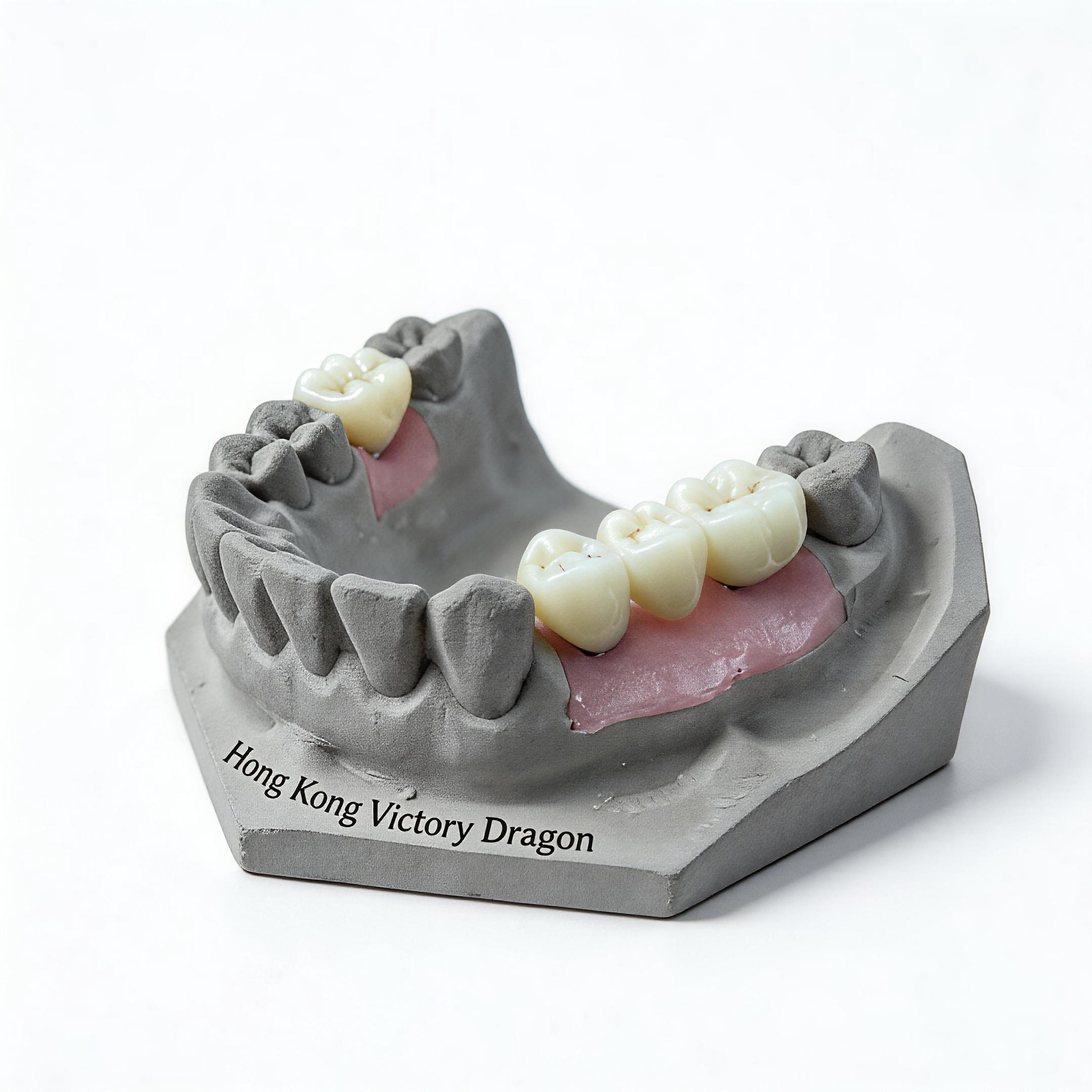 Implant Prosthetics